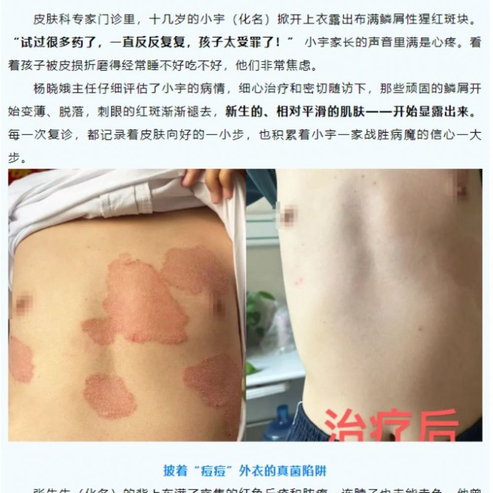 近期丨多位久治不愈皮肤病患者在此康复